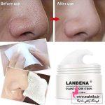 نمایندگی محصولات لانبنا | چسب بینی لانبنا عمده