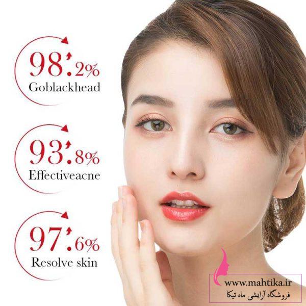 سرم ضد جوش و آکنه سالیسیلیک اسید بیو آکوا