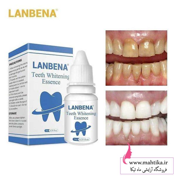 قیمت خرید عمده سفید کننده دندان لانبنا