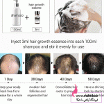 سرم ضد ریزش و پرپشت کننده مو لانبنا