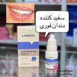 قیمت خرید عمده سفید کننده دندان لانبنا