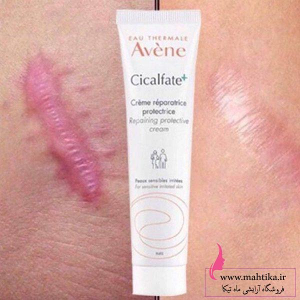 اووون قیمت عمده ترمیم کننده و ضدلک سیکالفیت