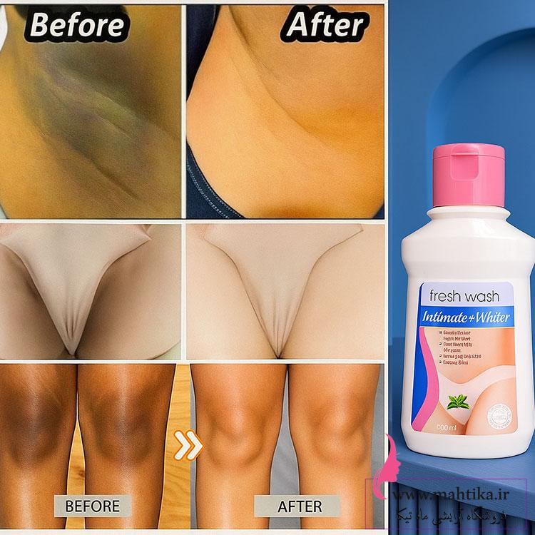 وکالییییی-روشن-کنندههه قیمت خرید عمده کرم روشن کننده ناحیه حساس