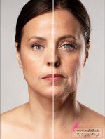 قیمت خرید عمده بانک کلاژن کلامین بسته بندی سبز اصلی